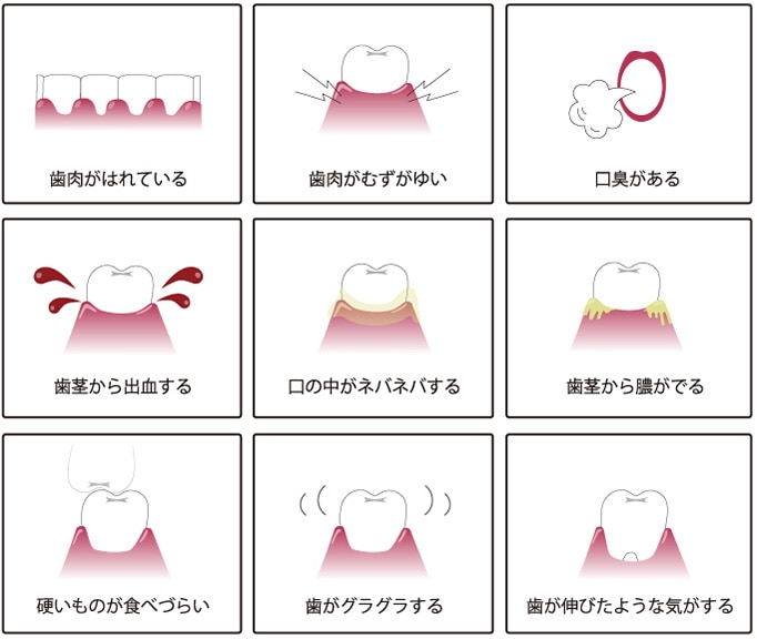 歯肉がはれている、歯肉がむずがゆい、口臭がある、歯茎から出血する、口の中がネバネバする